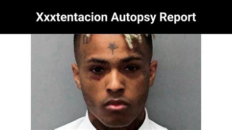 xxxtentaction autopsy photos|XXXTentacion’s Alleged Autopsy Report Surfaces Online